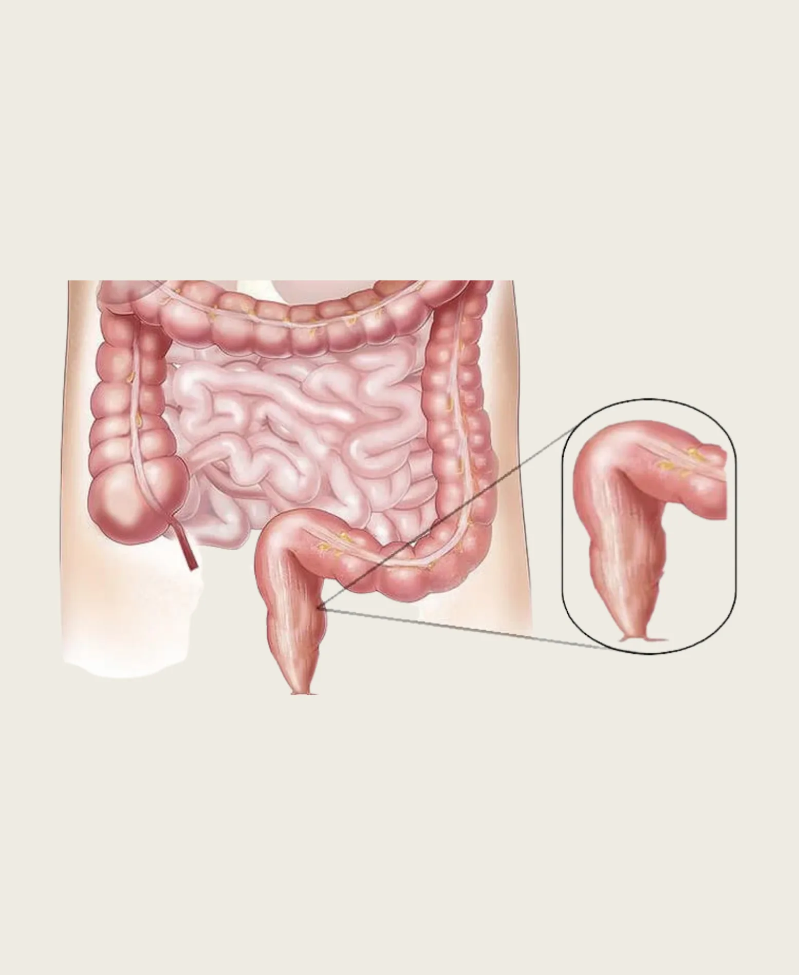 Dr. Neel Patel - Colon & Rectal care at Niraaya Hospital Gandhinagar